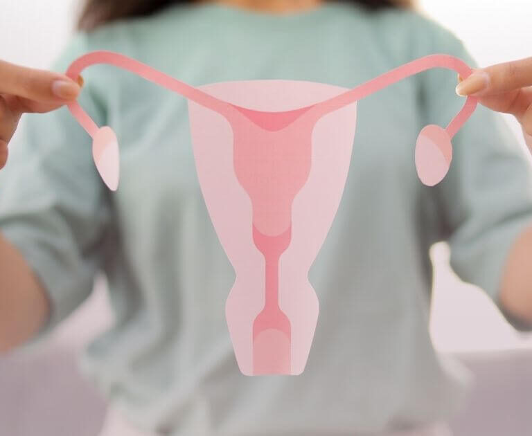 PCOS – What Is It? 6 co to jest pcos