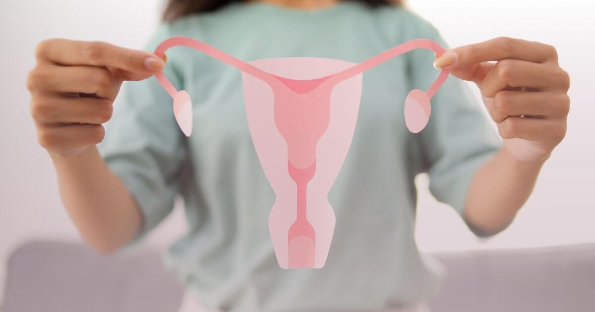 PCOS – What Is It? 1 co to jest pcos